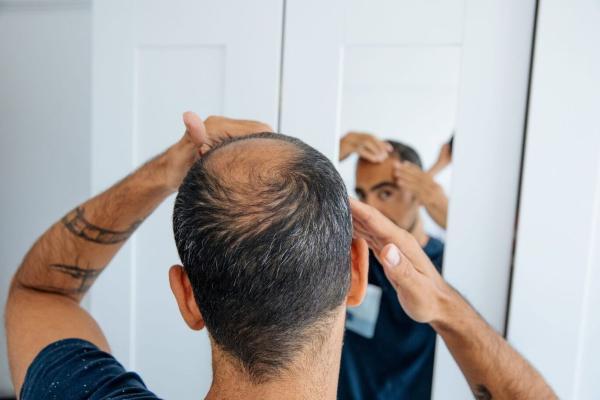 ترفند های ساده ای که از ریزش موی شما جلوگیری می نماید!