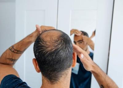 ترفند های ساده ای که از ریزش موی شما جلوگیری می نماید!